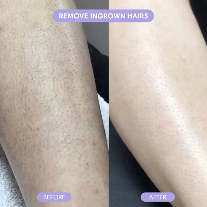 GlideLuxe™ — Effortless Smooth Legs That Feel Absolutely Pampered Every Day