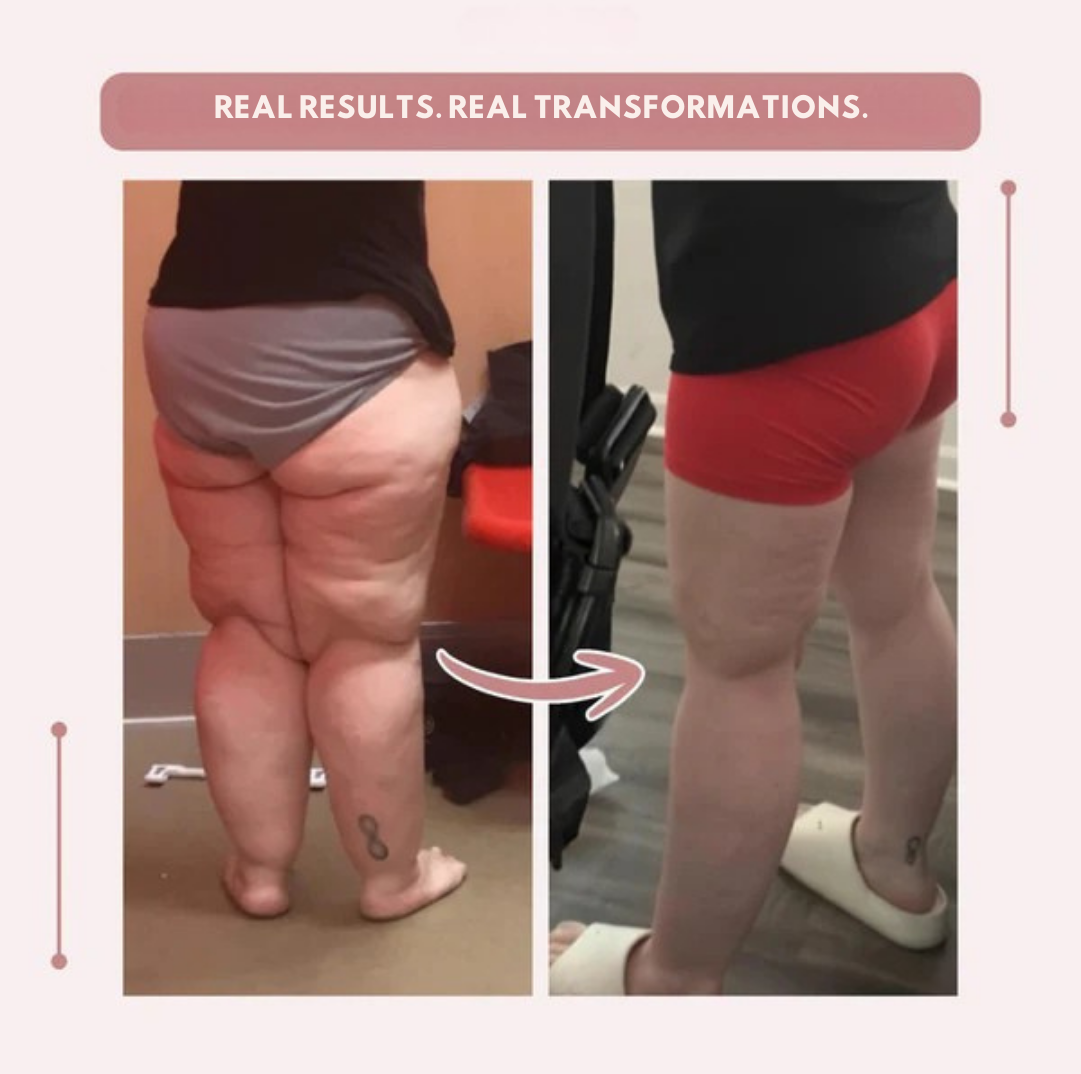 Vibrissea™ — Feel Flawless and Fierce in Every Curve