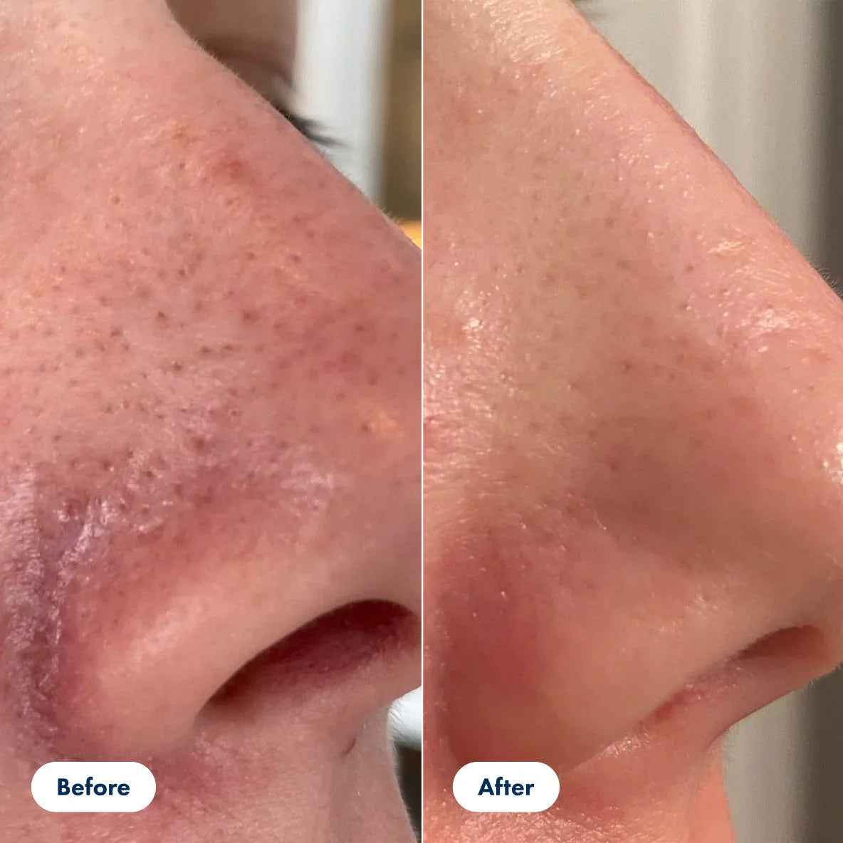 SilkVeil™ Radiance Serum — Unlock Silky-Smooth Skin That Dazzles Confidence Instantly