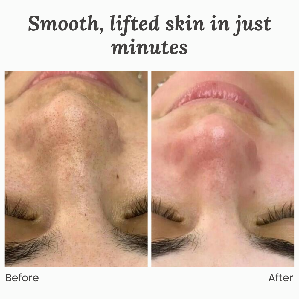 GlowRenew™ — Unlock Your Skin’s Natural Glow and Feel Radiant Every Day