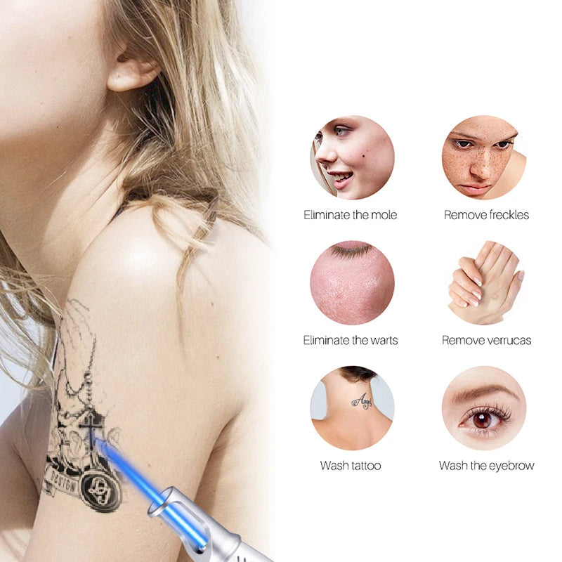Home Laser Solution for Tattoo and Skin Blemish Removal