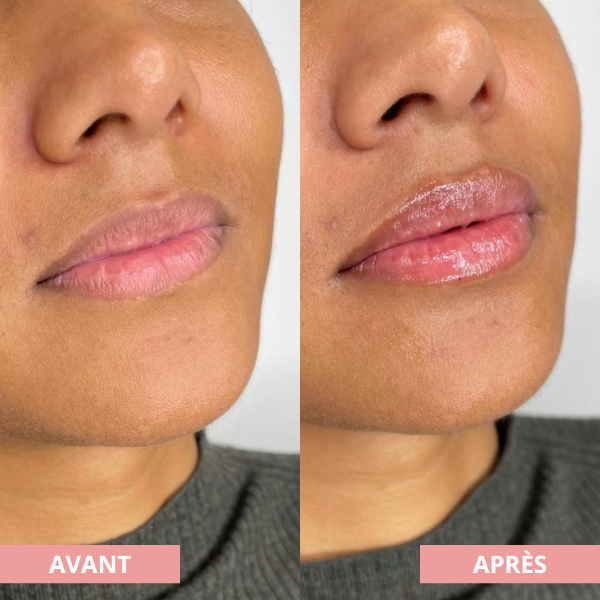 Arvilaro | Kit Ritual Lips - Thicker & Shiny lips in minutes