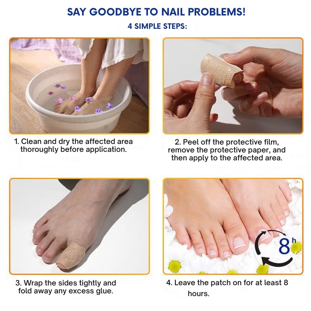 SilkDerm™ Nail Renewal Patches — Clear, Strong Nails That Make You Proud to Bare Your Feet
