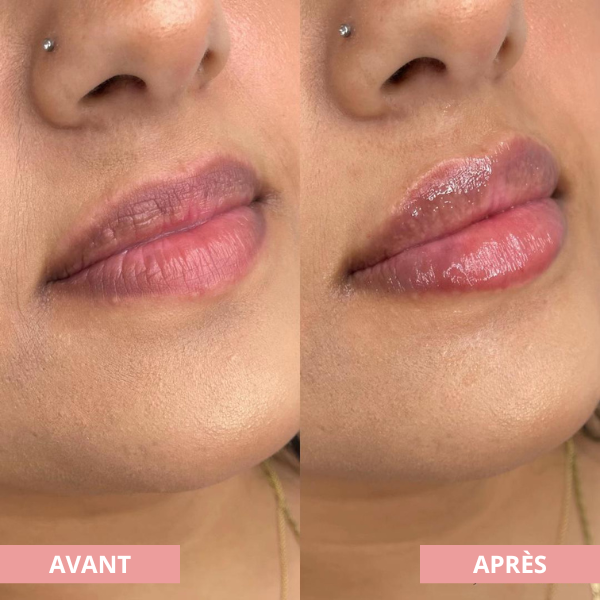 Arvilaro | Kit Ritual Lips - Thicker & Shiny lips in minutes