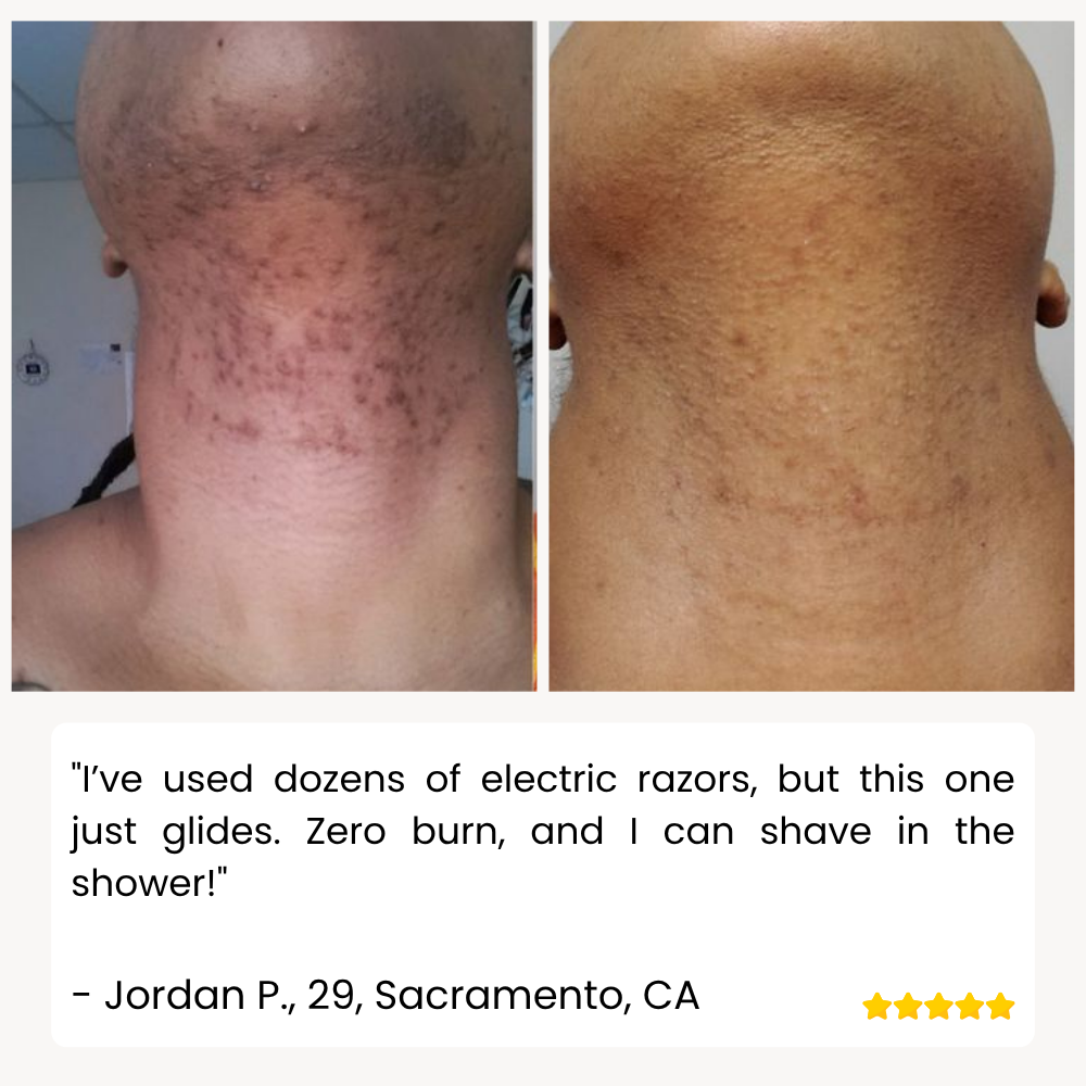 RamoxoPro™ — Effortless Precision Shaving That Leaves Your Skin Silky-Smooth and Irritation-Free