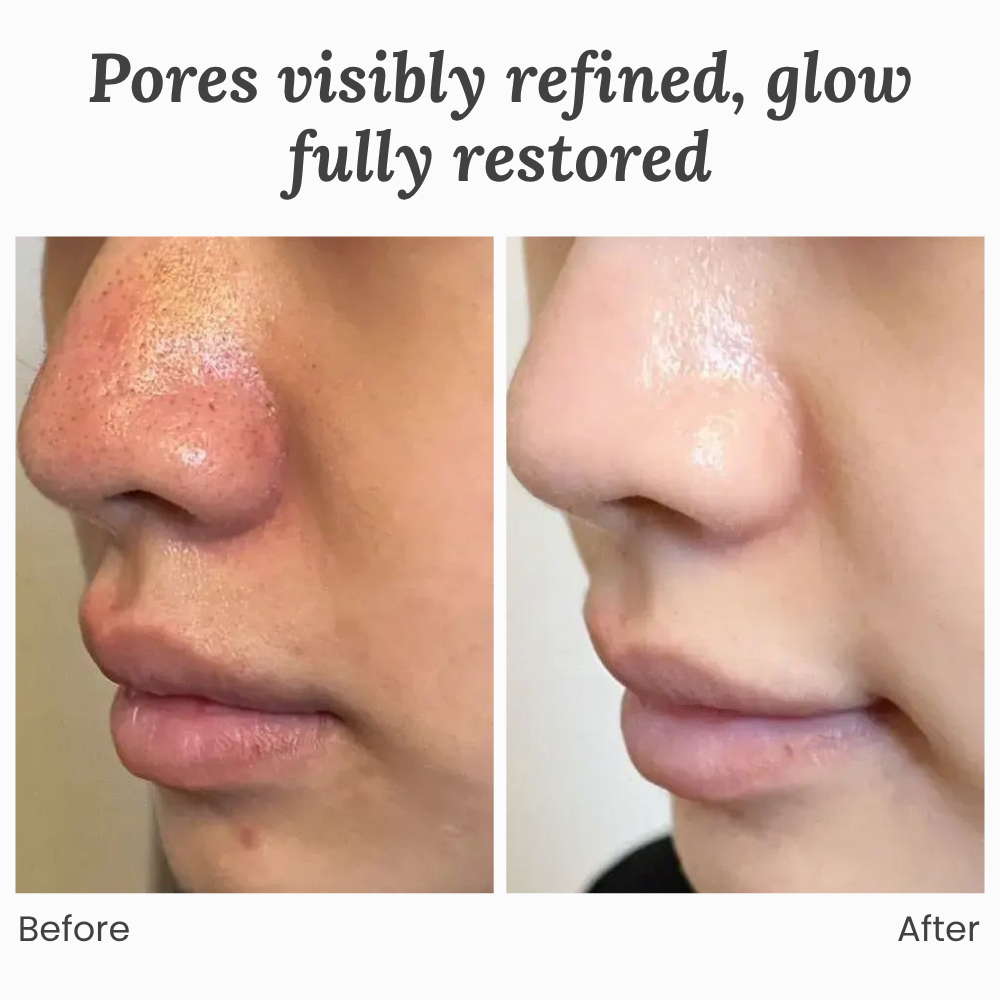 GlowRenew™ — Unlock Your Skin’s Natural Glow and Feel Radiant Every Day