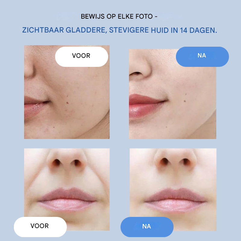 NovaLift™ Reveal Strips — Instantly Lift and Renew Your Skin for a Youthful Glow