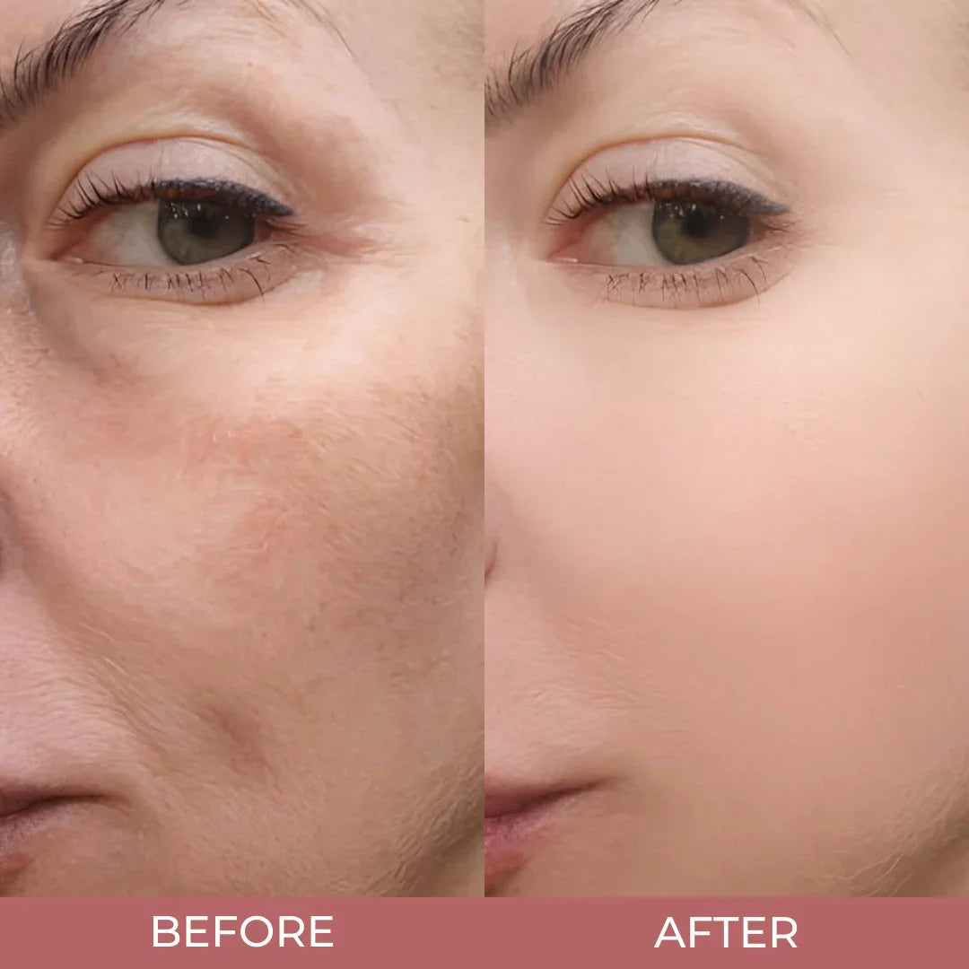 Arvilaro's Peel Shot Glow Rice Ampoule