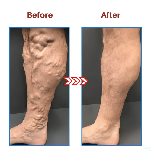 StrideNova™ — Feel Energized, Pain-Free Feet That Carry You All Day