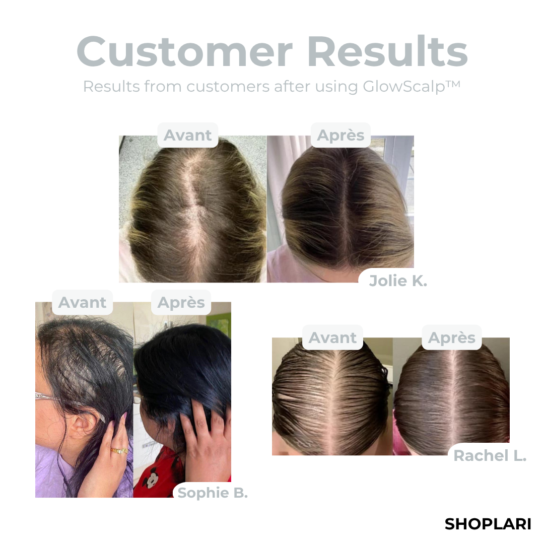 VividRoot™ — Revive Your Hair and Confidence with Every Light Pulse