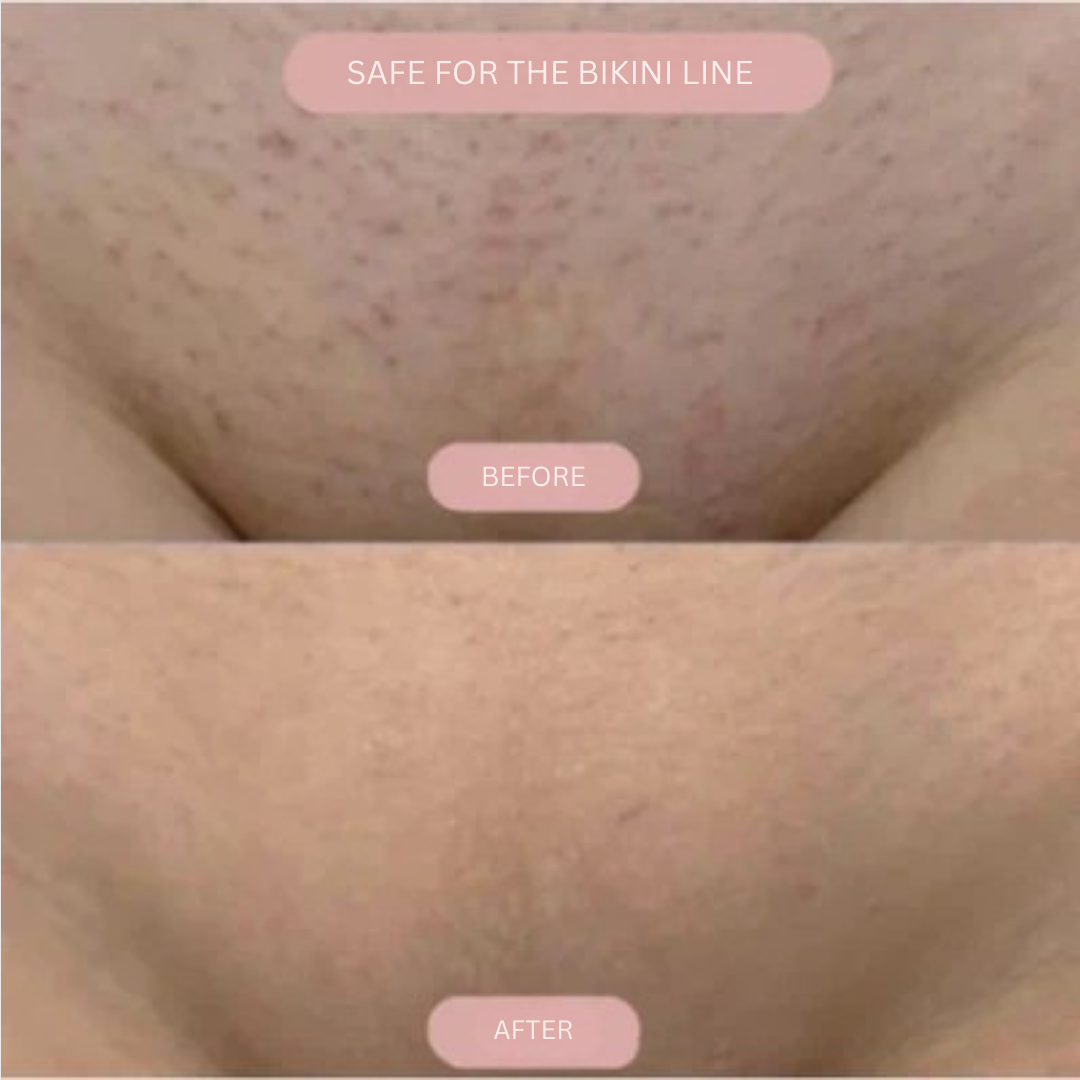 VelvetEase™ — Experience Pain-Free Shaves That Reveal Silky, Confidence-Boosting Skin Every Day