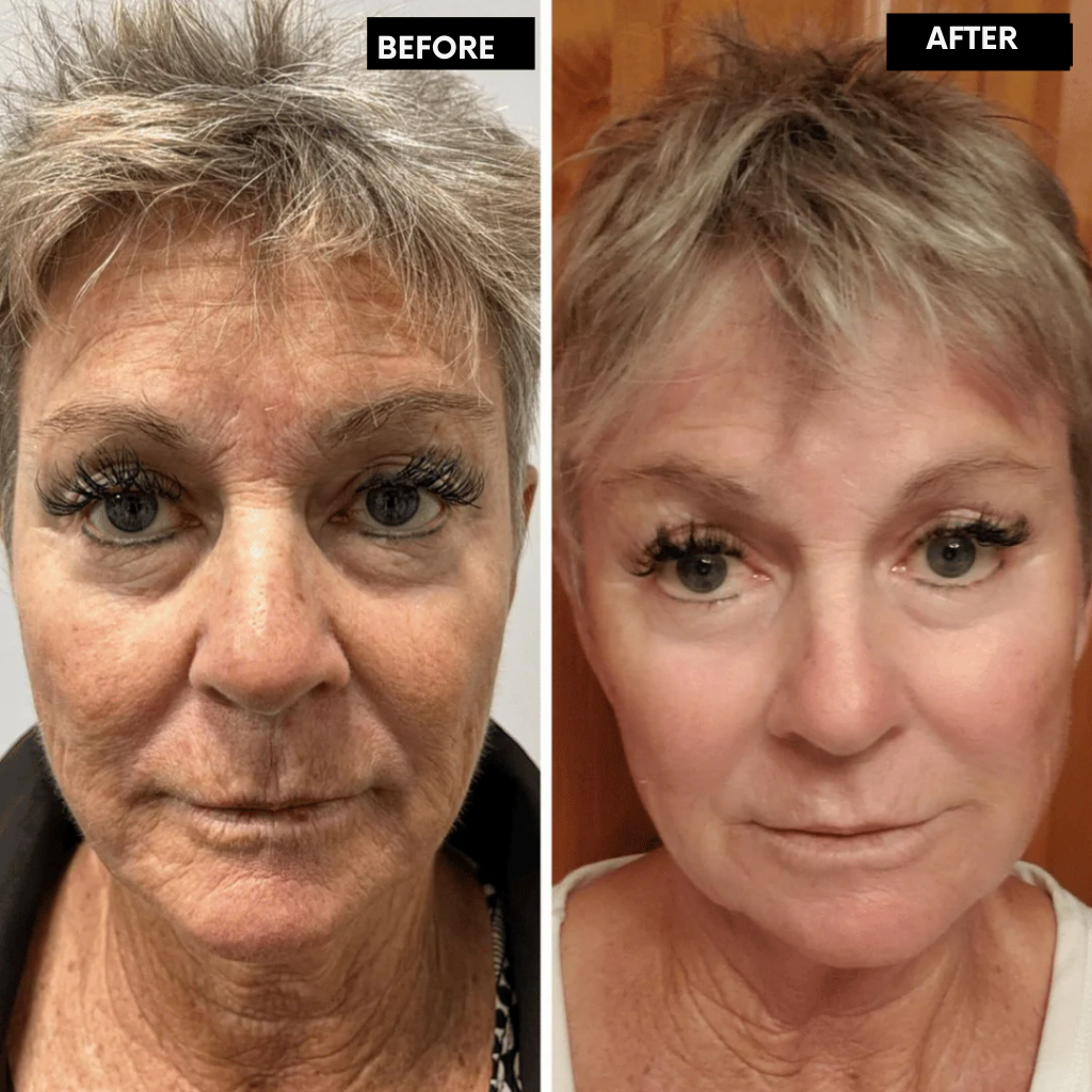 RadianceLift™ — Unleash Youthful Glow and Firm, Silky Skin in Just Two Weeks
