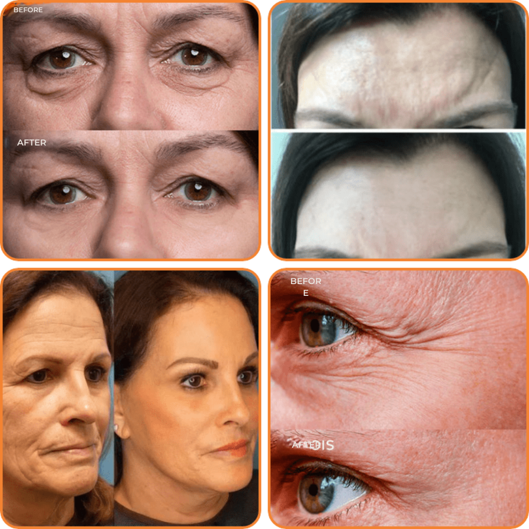 RejuvaRise™ — Snap Back to Youthful, Radiant Skin in Days