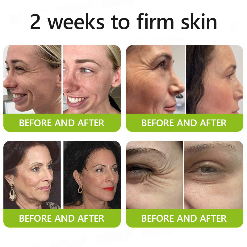 LysoriaLift™ — Reveal Firmer, Radiant Skin That Turns Back Time Without Needles