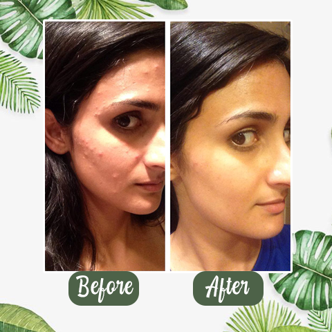 PoreVive™ Detox Mask Stick — Reveal Fresh, Shine-Free Skin That Commands Attention