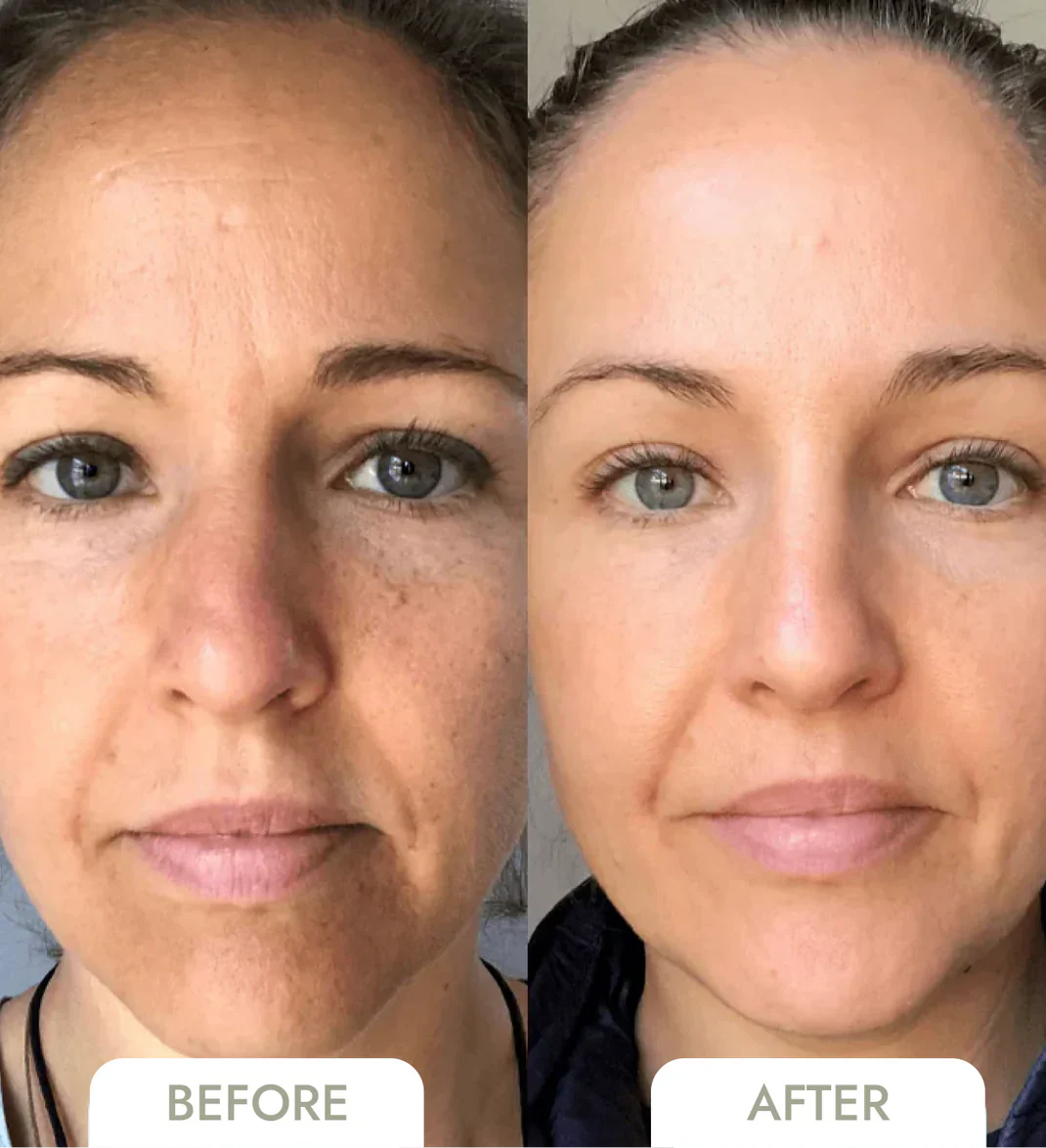 DermaSculpt™ Collagen Infusion — Reveal Firmer, Radiant Skin That Defies Time
