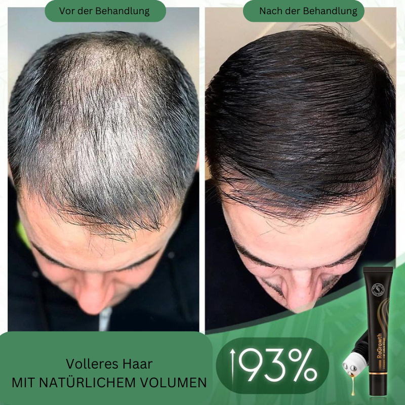 VitaVave™ — Ignite Your Hair’s Fullest, Thickest Glory Every Day