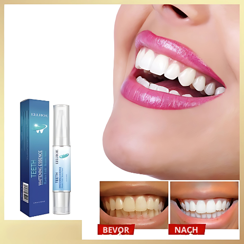 RadianceRush™ Whitening Pen — Reveal a Radiant Smile That Commands Attention Instantly