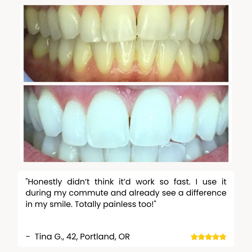 DiamondShine™ Whitening Pen — Unleash a Radiant Smile That Commands Attention Instantly