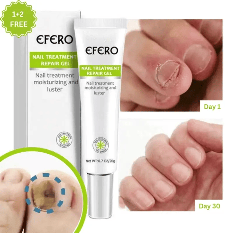 VeraNail™ — Transform Your Nails from Shame to Stunning Confidence