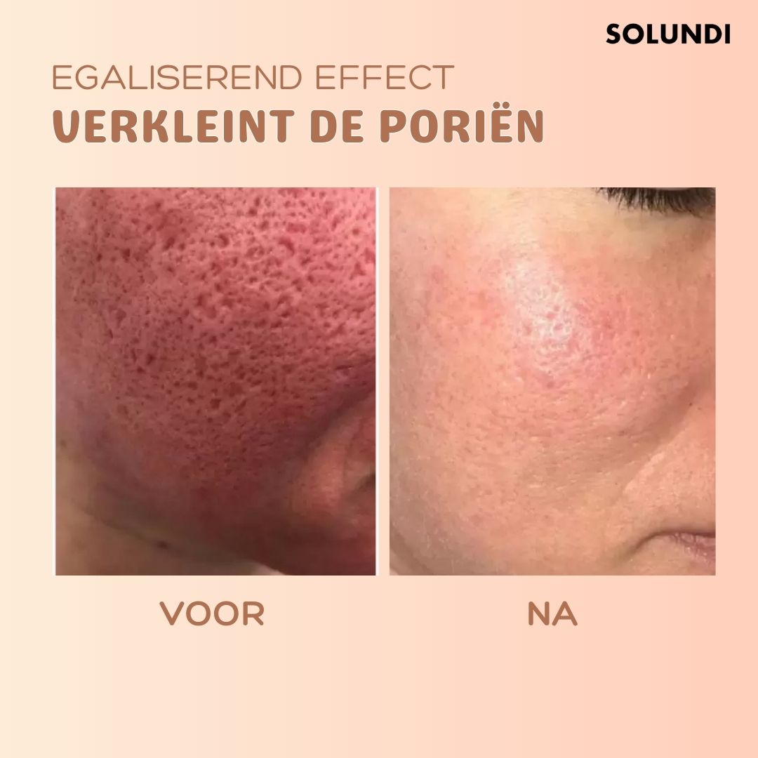LumaSilk™ — Instantly Smooth Wrinkles and Reveal Radiant, Youthful Skin