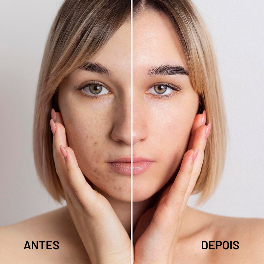 RamoraLuxe™ — Unlock Your Skin’s Radiant, Flawless Confidence Every Day