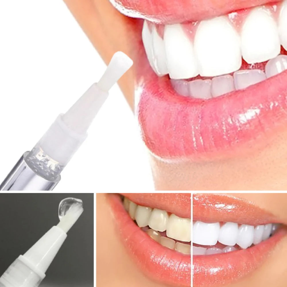 RadianceBeam™ — Ignite Instant Confidence with a Brilliant, Pain-Free Smile