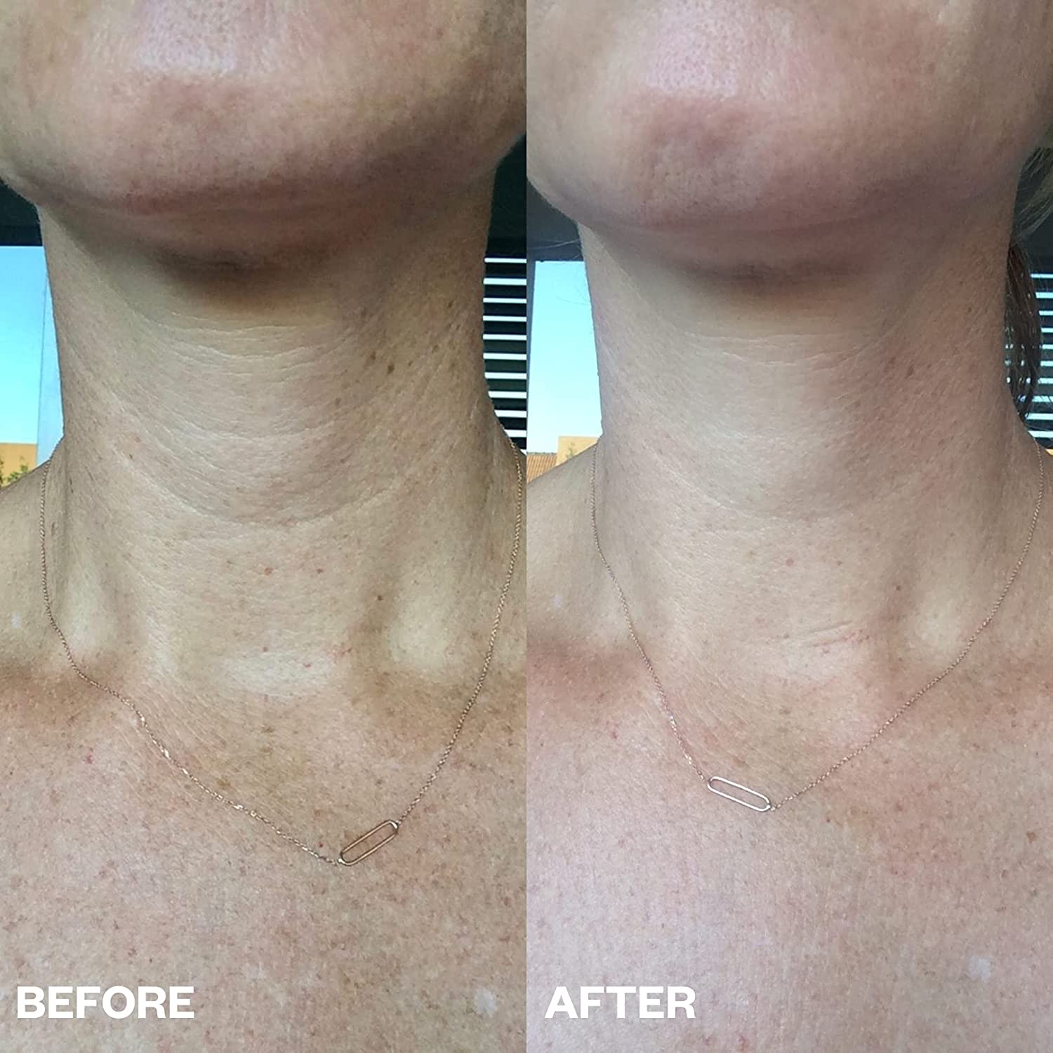 Wrinkle Reduction Pads