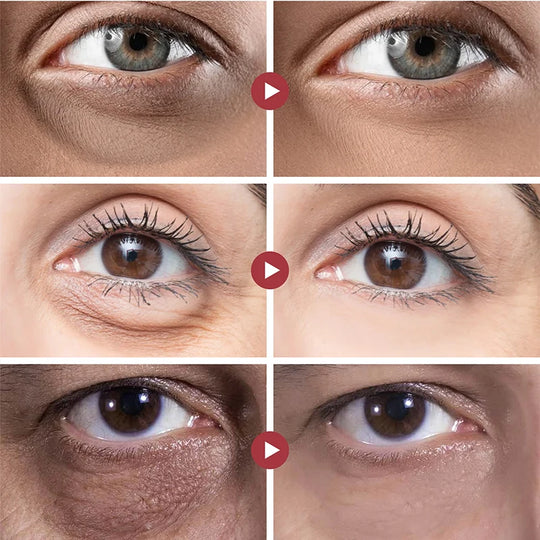 Anti-Aging Eye Cream for Dark Circles and Wrinkles – Hydrating Formula