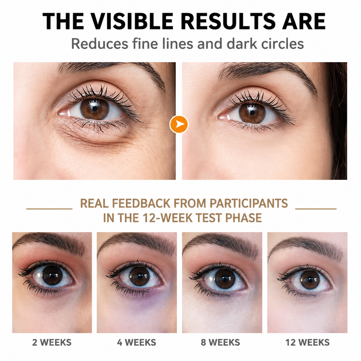 Anti-Aging Eye Cream for Dark Circles and Wrinkles – Hydrating Formula