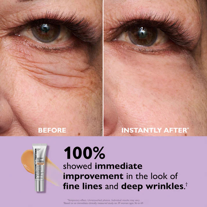 Eye Cream for Dark Circles & Wrinkles | Instant Fresh Look