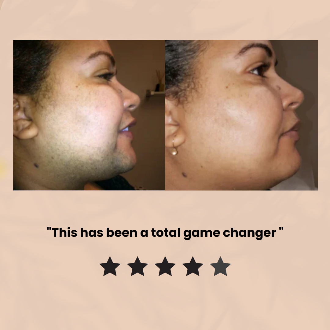 Smooth Skin Hair Removal Cream for Women