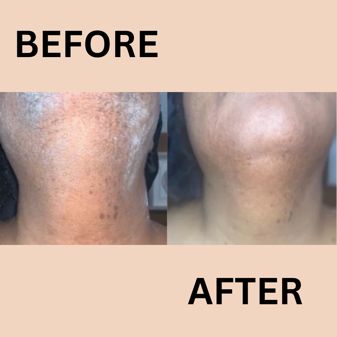Smooth Skin Hair Removal Cream for Women