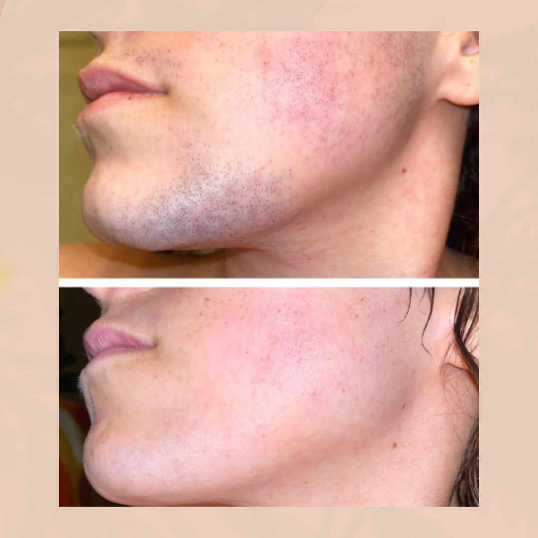 Smooth Skin Hair Removal Cream for Women