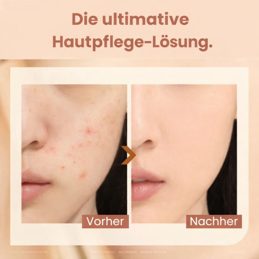 Concealer and Foundation Color Change for a Natural Complexion