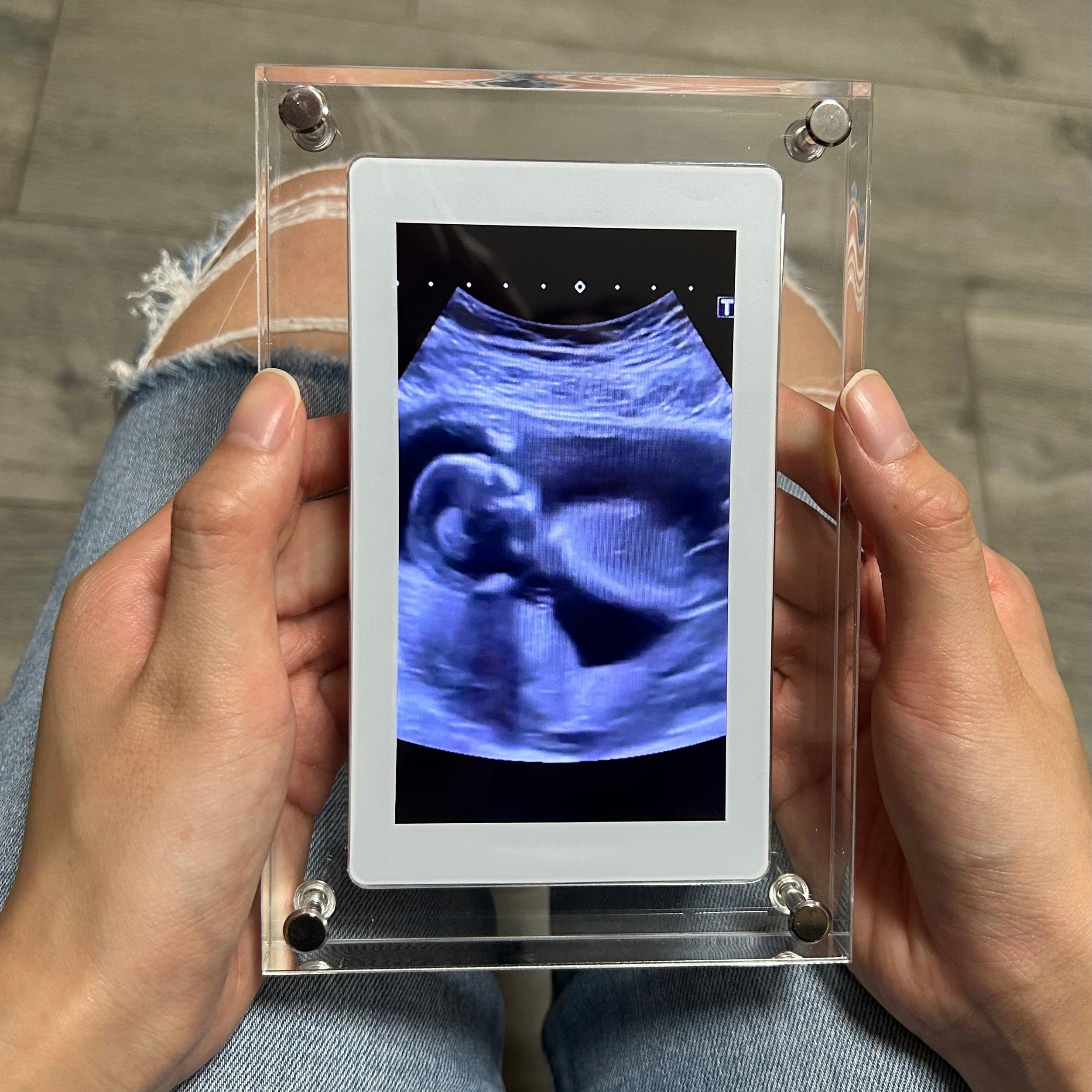 Elegant Digital Frame with HD Video and Rotating Display