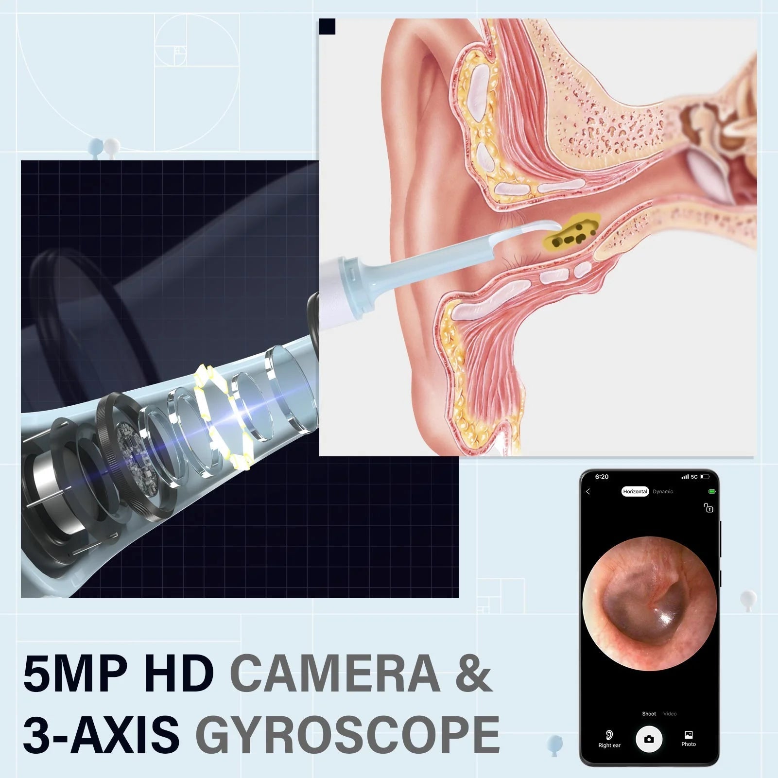 Effortless Earwax Removal with Real-Time Visualization Device