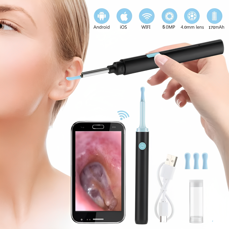 Effortless Earwax Removal with Real-Time Visualization Device