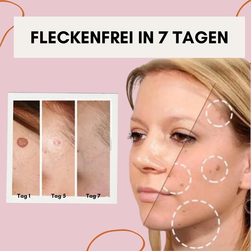 Say Goodbye to Skin Imperfections with Flawless Fade