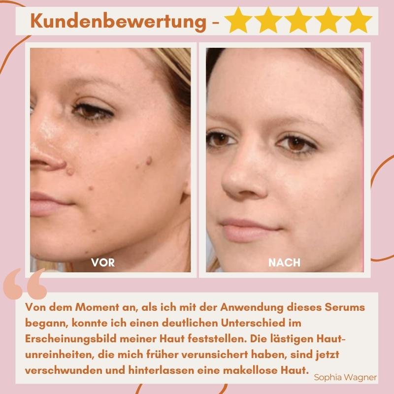 Say Goodbye to Skin Imperfections with Flawless Fade