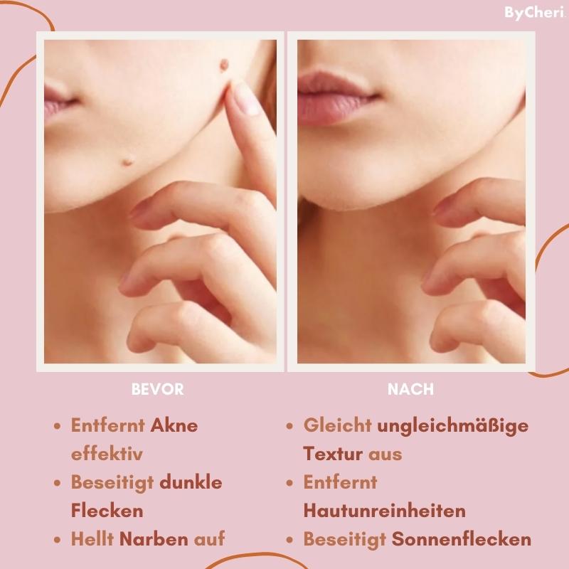 Say Goodbye to Skin Imperfections with Flawless Fade