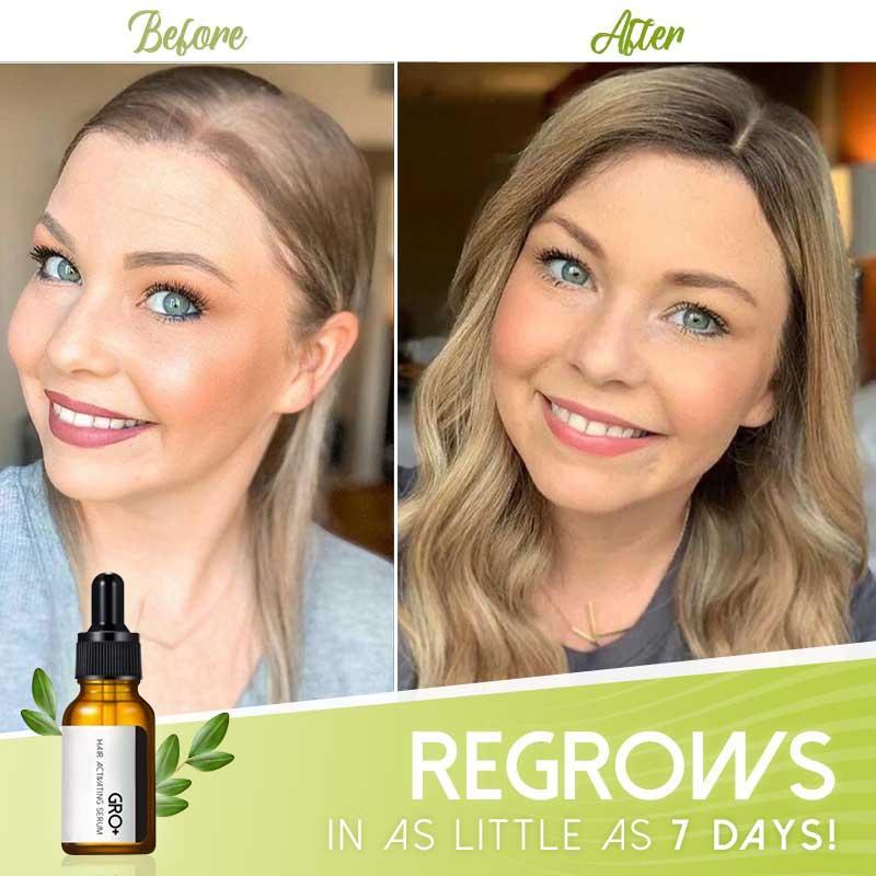 Hair Serum for Thicker Hair – GRO+ Formula