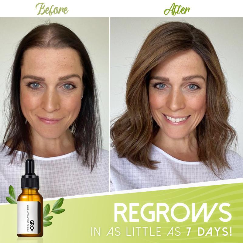 Hair Serum for Thicker Hair – GRO+ Formula