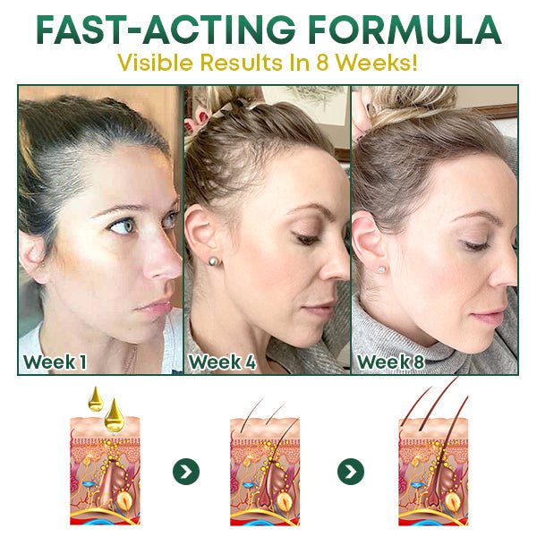 Natural Hair Enhancer for Thicker Growth
