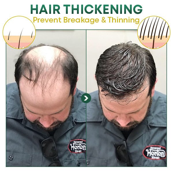 Natural Hair Enhancer for Thicker Growth