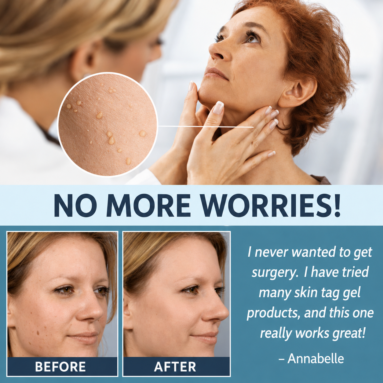 Skin Tag Removal Patch | Natural & Pain-Free Label Remover