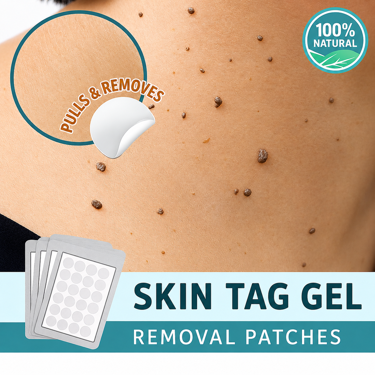 Skin Tag Removal Patch | Natural & Pain-Free Label Remover