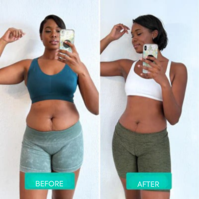 Firming Skin Slimming Massager with Vibration Therapy