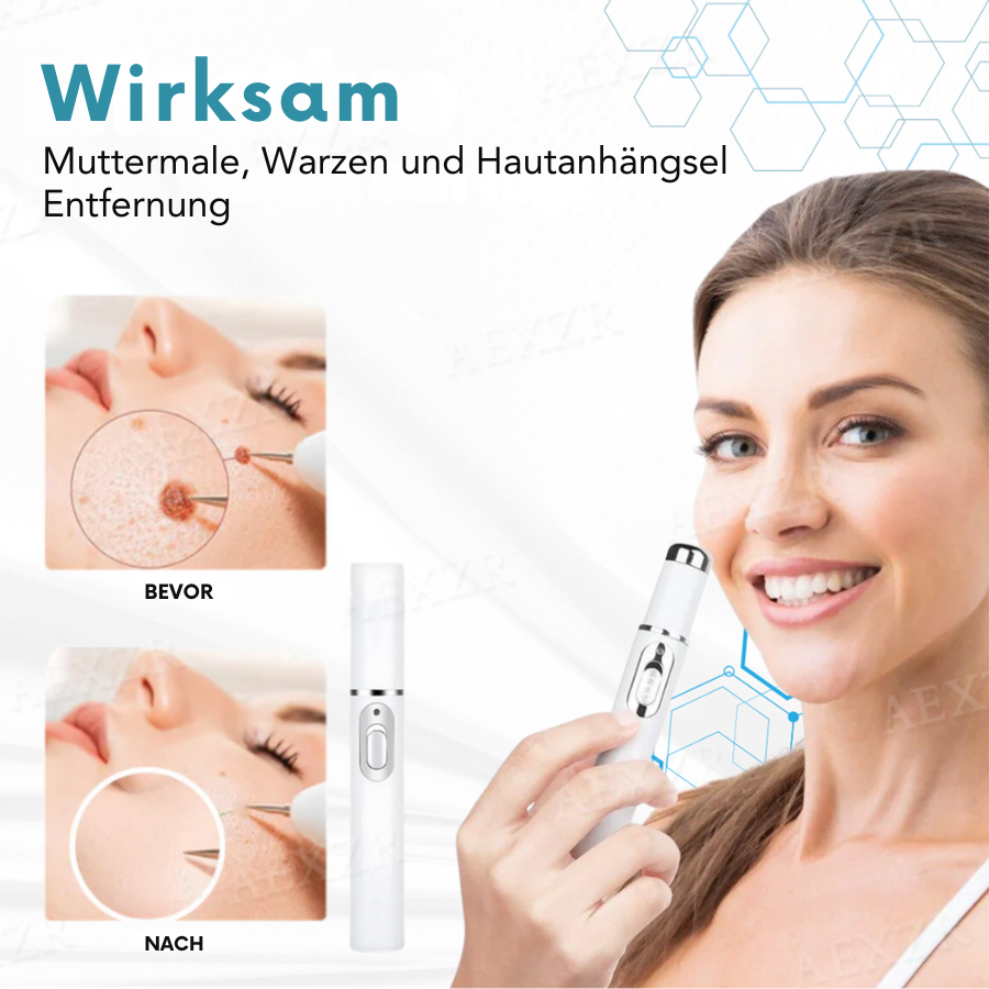 Skin Rejuvenation Pen | Accurate Skin Correction | Non-Invasive Plasma Technology