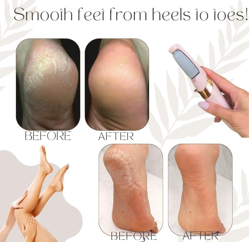 Rechargeable Waterproof Callus Remover with Quartz Crystal Rollers